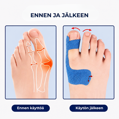 AlignTape™ | Valmiiksi leikattu elastinen kinesioteippi hallux valgus -tukeen