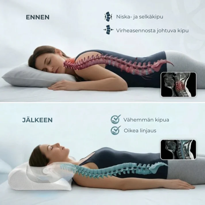 ErgoPillow™ | Anna niskallesi tuki, jota se on kaivannut joka yö